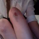 Millll_A