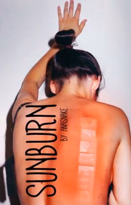 Sunburn | njh