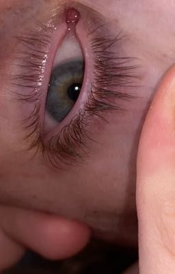 Вторая жизнь