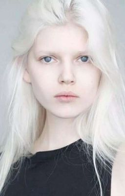 Привет, я альбинос.