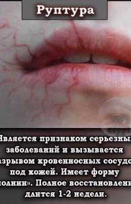 My Жизнь