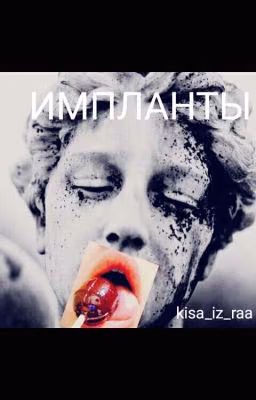 Импланты