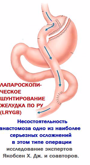 0566e3bf9c26d766236cbc41bf7233bb.avif