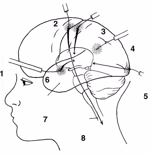 0aef6a0330c7a213af9e0e4ae900c8bd.avif