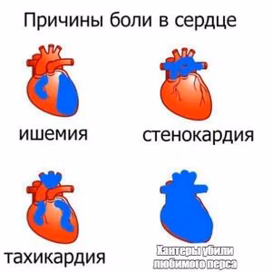 0ef38af21a55b29b5515306672b1ae91.avif