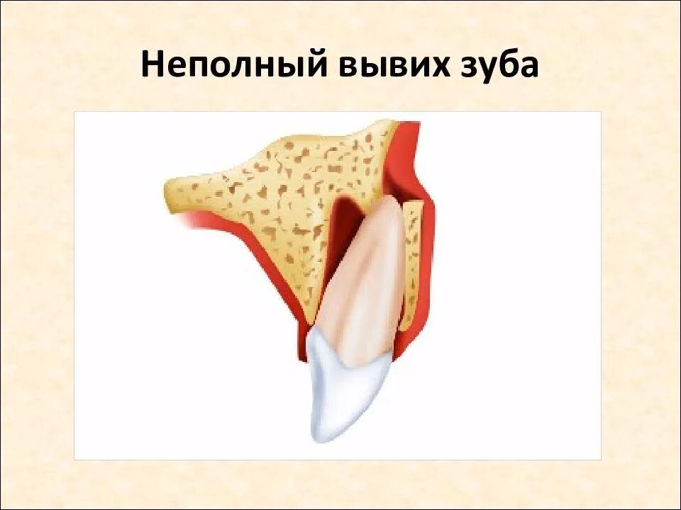0fdef0809b0993c211dc0e5896a0e233.avif