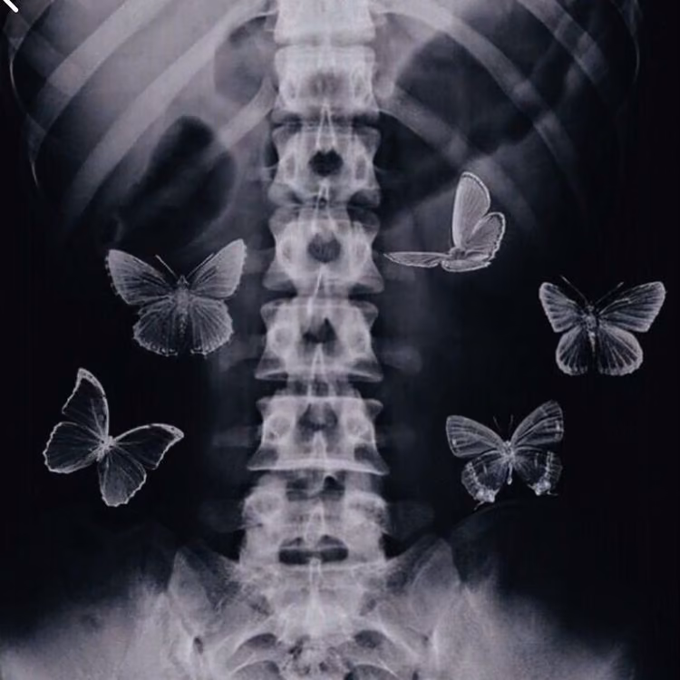 146c237b65a73b1fe274e17624cc84e6.avif