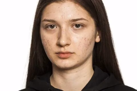 0RQ0gCgkXuyQCbGGbt9jDjkutvaP7aex9ZQIniVJ.jpg