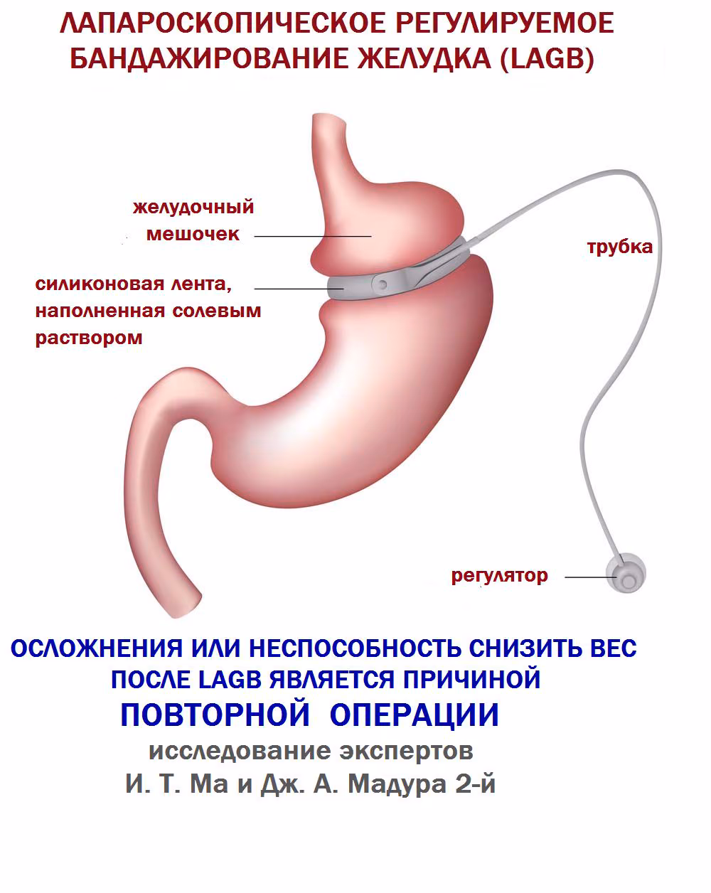 418a51e2c7e56b3cb0d93afcf4c0c0fe.avif