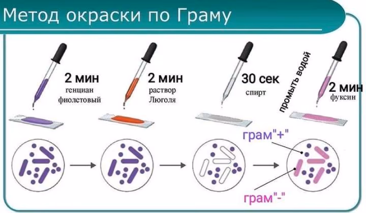 429322dcb8c425750d2069aab920813c.avif