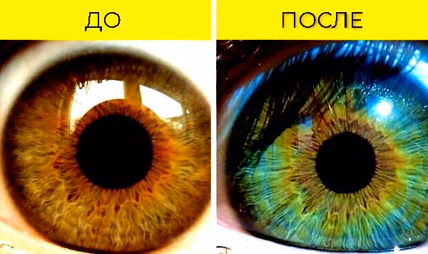 5ee09f2f844ae88d2cf15c1430d98551.avif