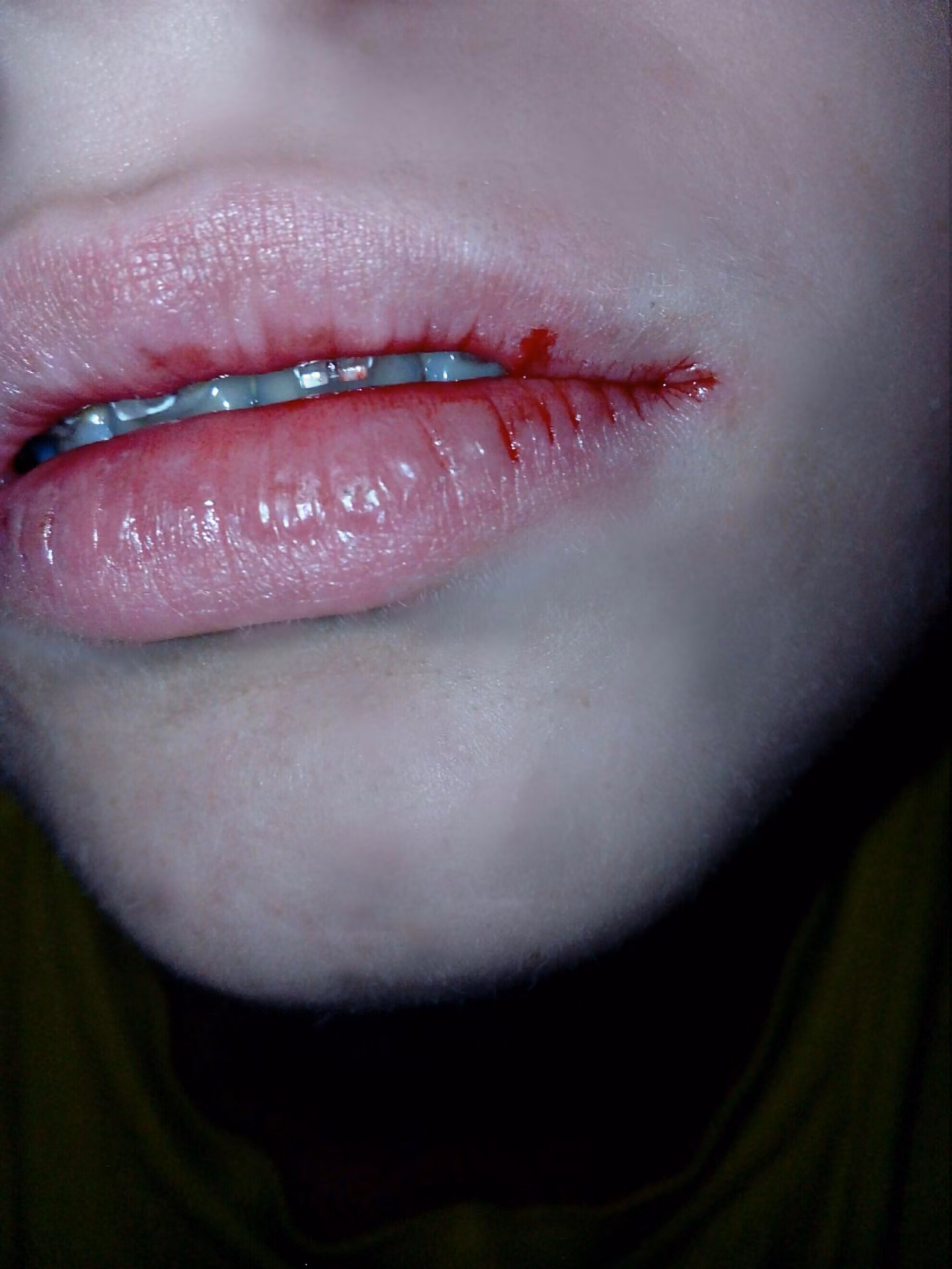 6a12f7d1bc21a1e31edb16c1bfbd87c1.jpg
