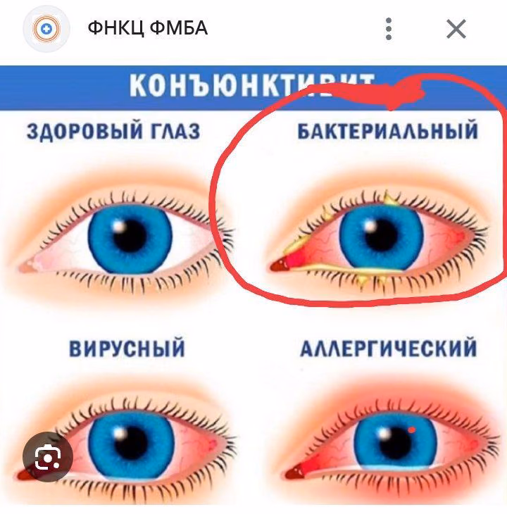 6bd7b56dac034ba697c2fb3aa465ac8f.jpg