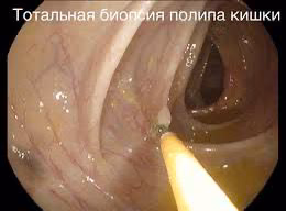 78cfdcd2f4ac9daa4f4f6d081c5cf30c.avif
