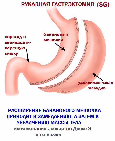 7b5cfffd9cfa88a01b3a67cc301b56ce.avif