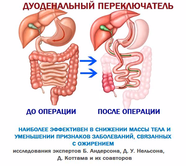 8d4e50ce64ffcdd06d9c025aa1973485.avif