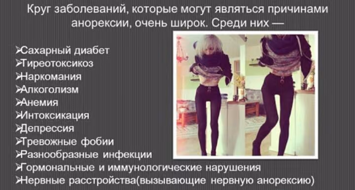 8e985ccafadfee4d46863904959ae5ed.avif