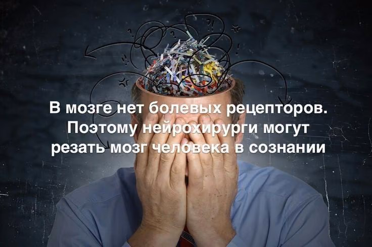 90c1795c003457f574725e61b4c828db.avif