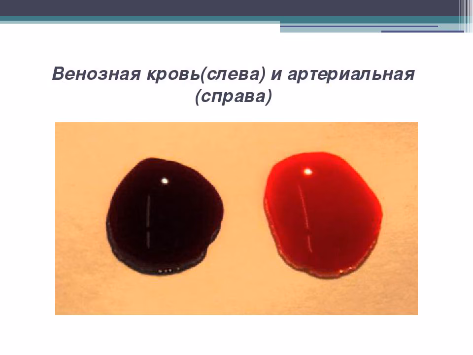 a02097805d2dd0a401afc5d1bcf933bf.avif