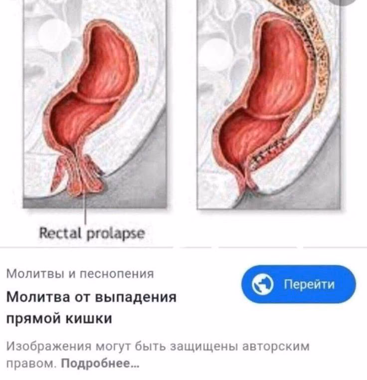 ad9233c935947ff42c37713c77d8815c.avif