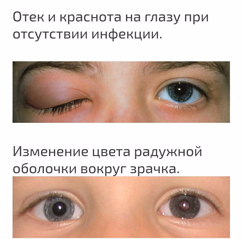 c761996c161f31f4806acbcdd492b67d.avif