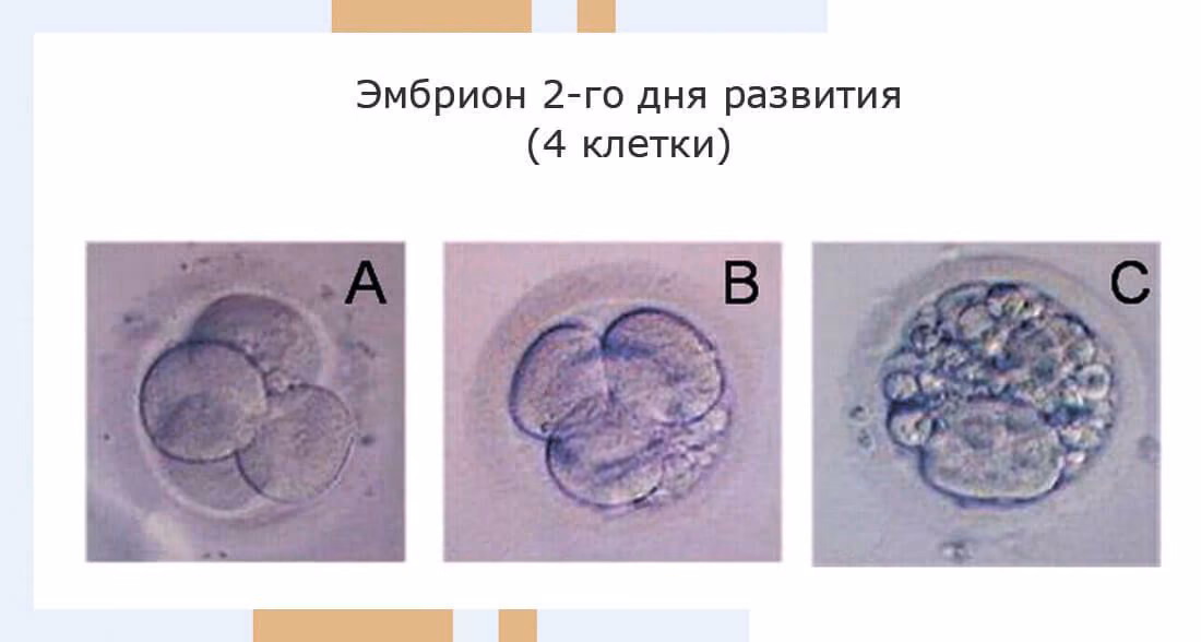c9639f6020b33976b02976a0e94e66b0.avif