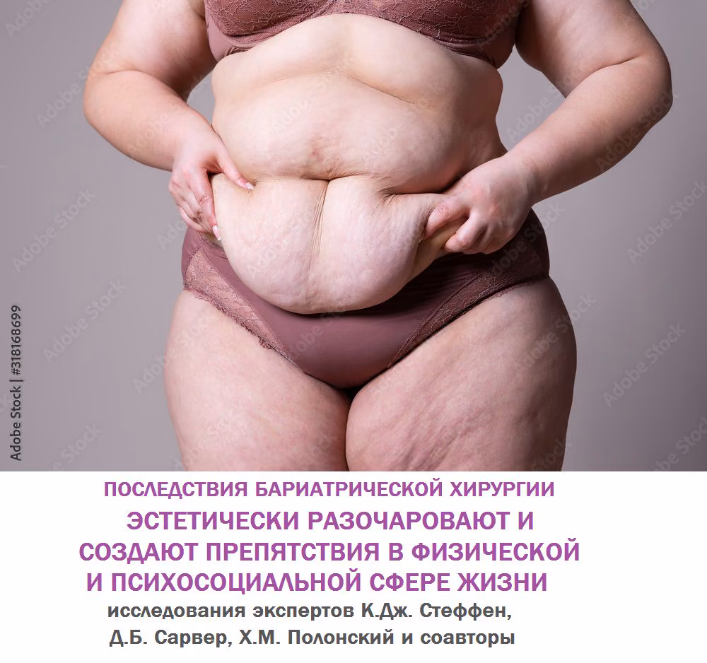 dabe5e6b672828d402ed9669cd9bbf11.avif